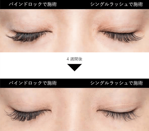 フラットマットラッシュとバインドロックの比較イメージ